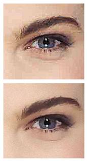 Eye before and after JPG repair